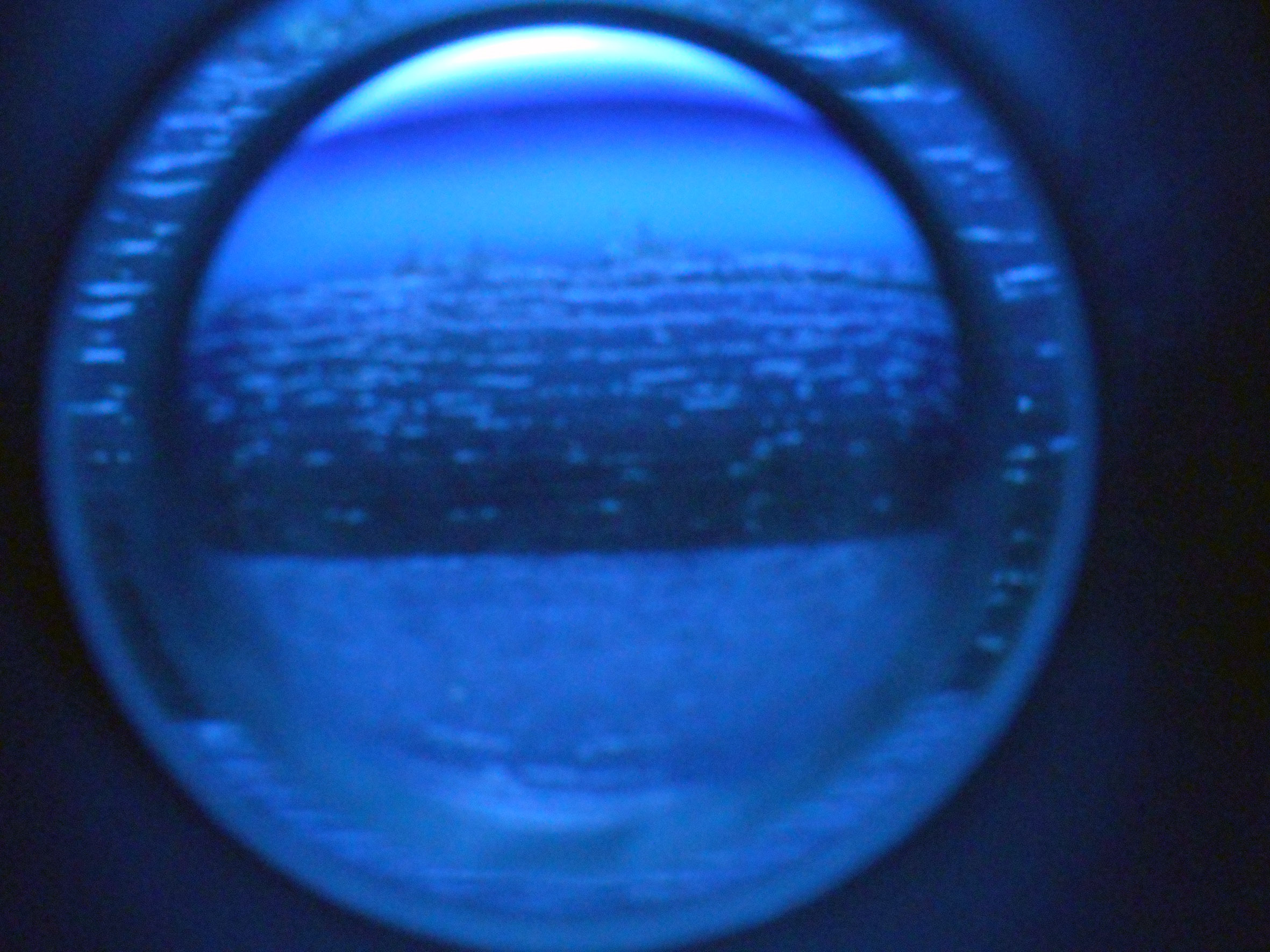 eye